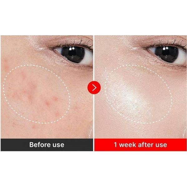 Антивіковий відновлюючий крем для обличчя Centellian24 Madeca Cream Time Reverse, 50ml MO-1829 фото