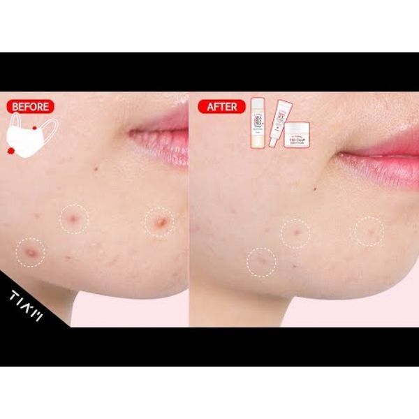 Зволожуючий гель-крем без олій Tiam AC Fighting Oil-Free Aqua Cream  M01009 фото