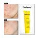 Очищающий гель для кожи с акне Acnemy Zitclean, 150 мл M00029 фото 3
